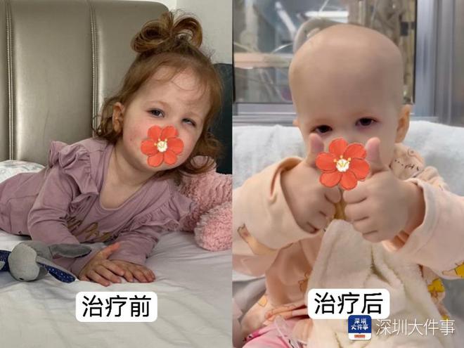 基因治療“逆天改命”！瑞典罕見遺傳病患兒萬里赴粵重獲新生(圖2)